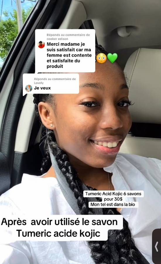 Après — Boutons d'acné, profil