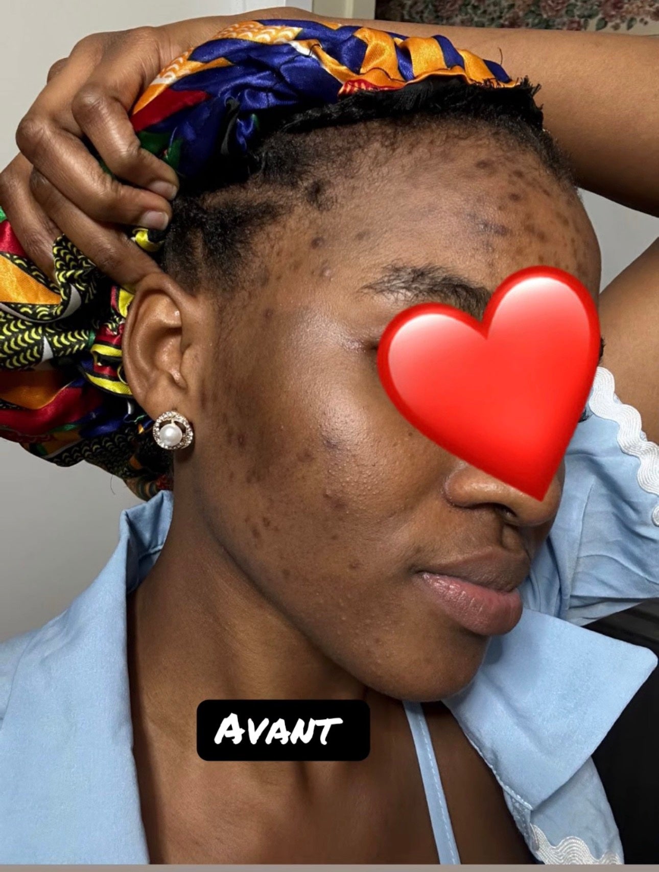 Avant